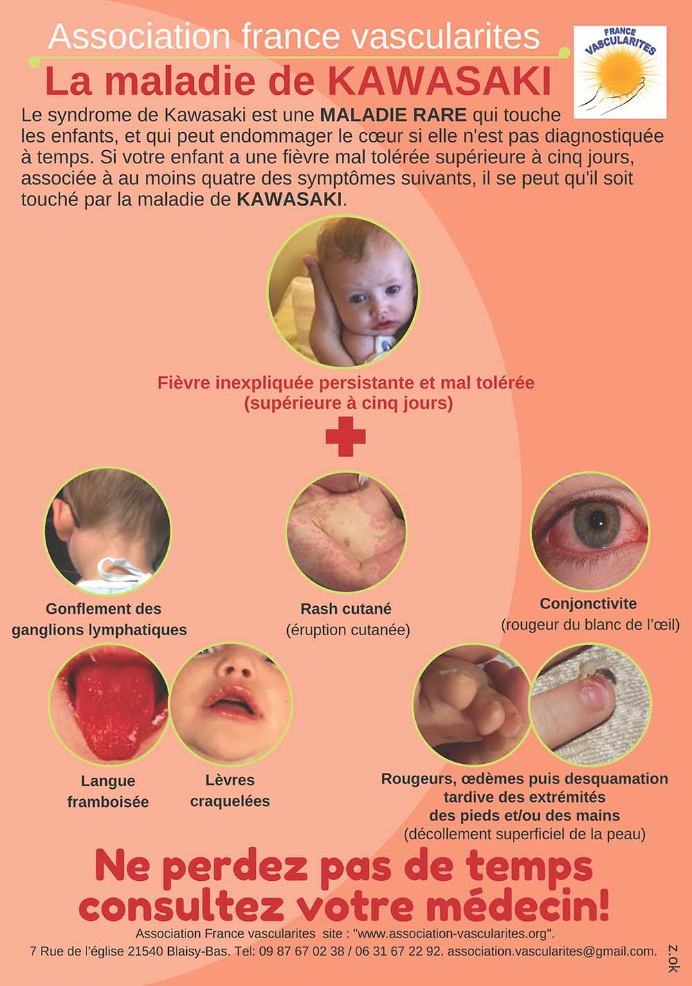 Complication mortelle du coronavirus : syndrome de Kawasaki