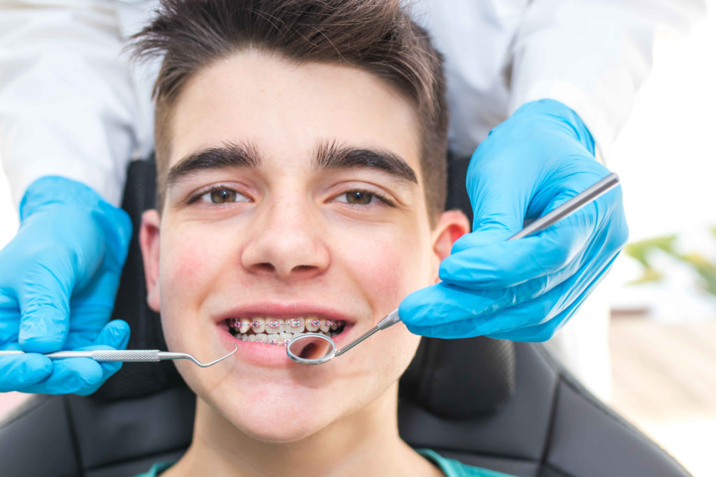 Pourquoi allez chez un orthodontiste ?